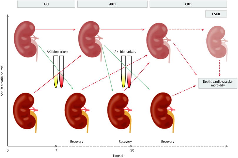 Recommendations on Acute Kidney Injury Biomarkers